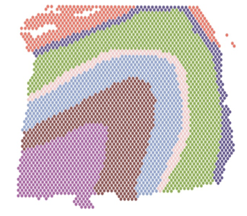 A Robust Statistical Approach for Finding Informative Spatially Associated Pathways